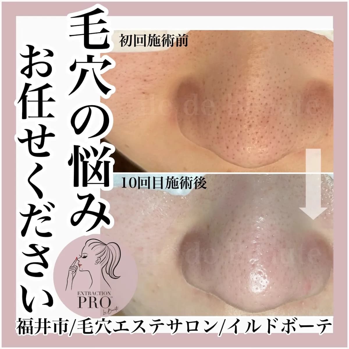 ile de Beaute (イル・ド・ボーテ)福井駅前エステサロン