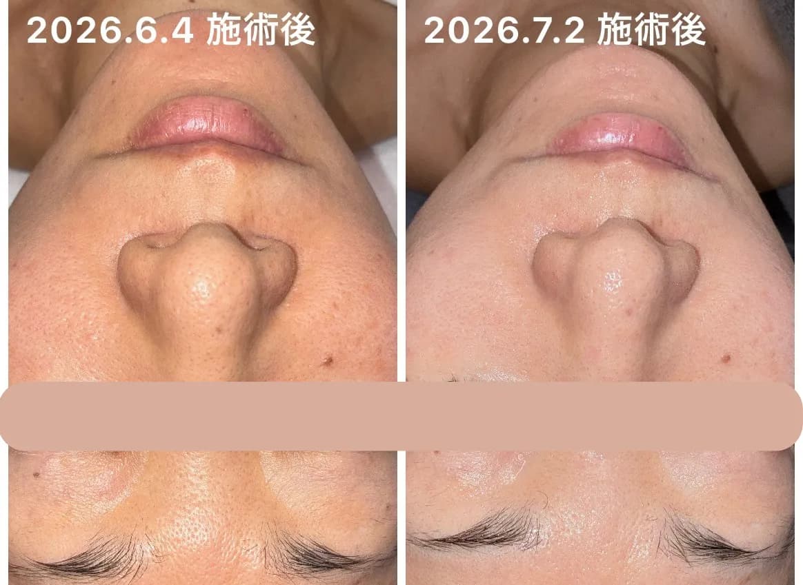 Salon Niné | シミ・毛穴|肌質改善サロン石山