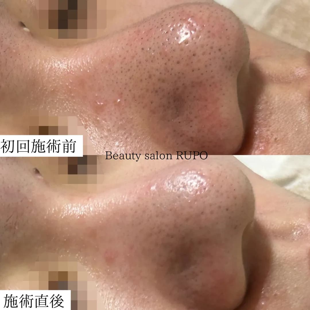 医療提携 Beauty salon RUPO 【ルポ】